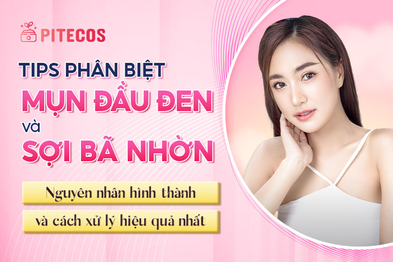 Cách phân biệt sợi bã nhờn và mụn đầu đen chuẩn nhất