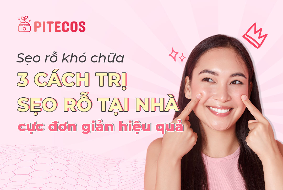 Sẹo rỗ khó chữa: 3 cách trị sẹo rỗ tại nhà cực đơn giản hiệu quả